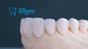 E-max Crowns Turkey Dental