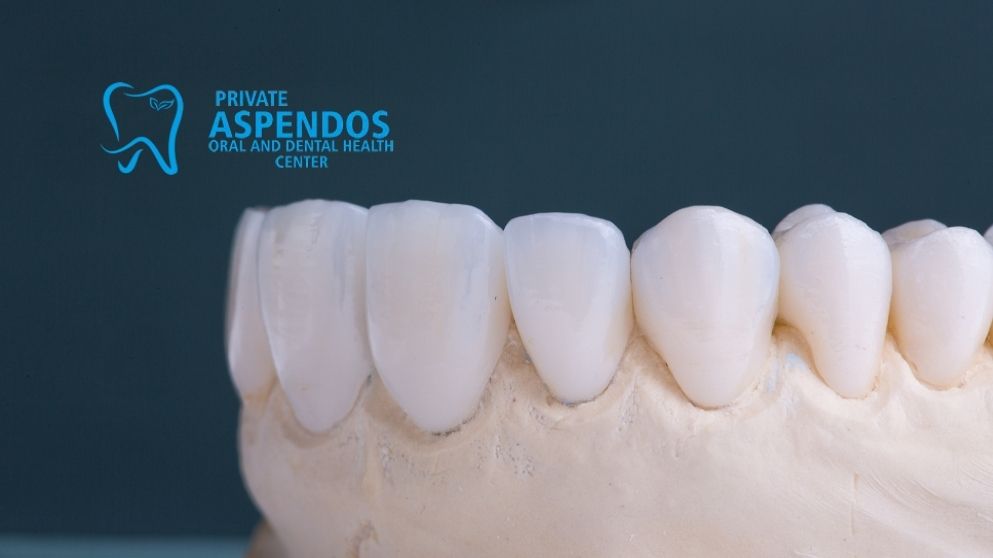 E-max Crowns Turkey Dental